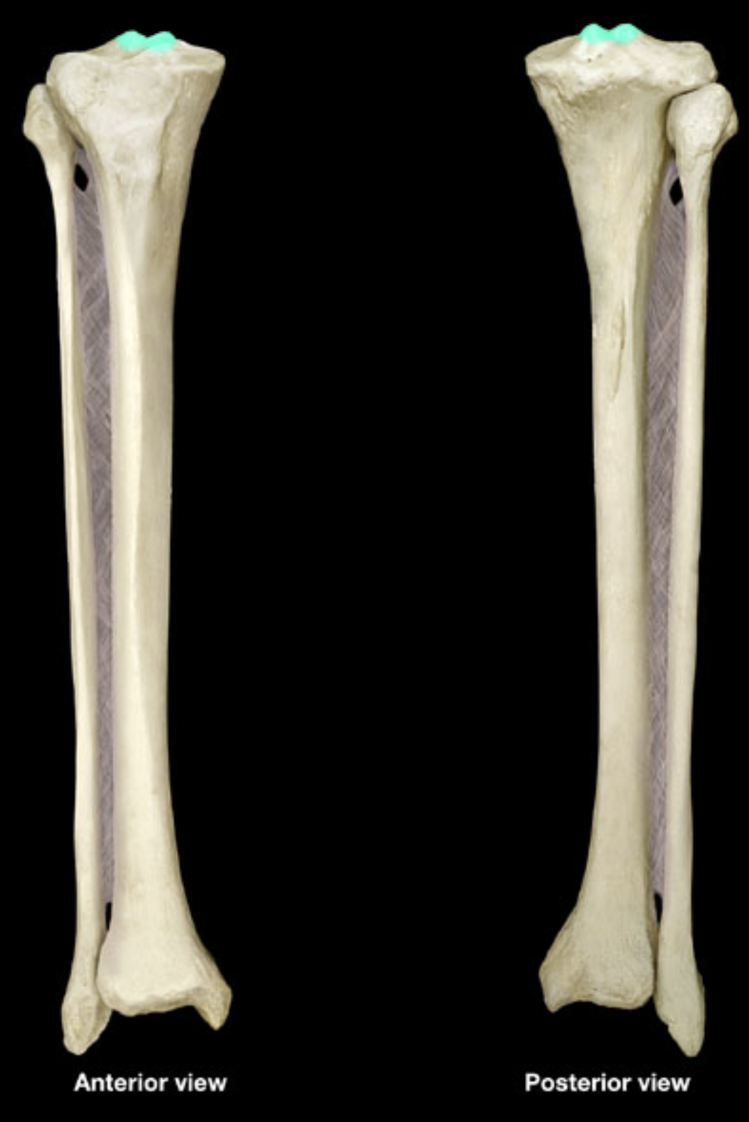 <p>of tibia</p>