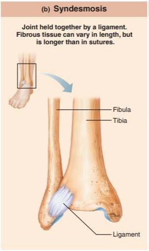 <p>bones connected by ligaments, bands of fibrous tissue</p><p>amphiarthrosis limited by length of ligaments</p>