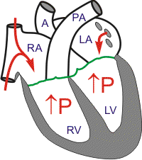 <p>The phase of systole when both valves are closed (and, as a result, the productive flow is zero)</p>