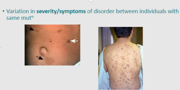 <p>Variation in severity/symptoms of the disorder between individuals with the same mutation</p>