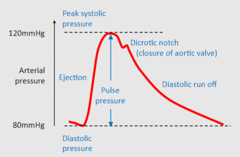 <p>Pulse pressure = Stroke Volume/Compliance</p>