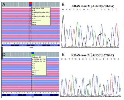 <p><strong>Readout Type</strong>: NGS produces a digital readout, whereas Sanger sequencing produces an analogue readout.</p><p><strong>Number of Sequences</strong>: Sanger sequencing produces one sequence read, while NGS generates a consensus sequence from multiple reads.</p><p><strong>Speed and Throughput</strong>: NGS offers high throughput and faster sequencing, whereas Sanger sequencing is slower and more limited in output.</p><p><strong>Cost</strong>: NGS is generally more cost-effective for large-scale sequencing compared to Sanger sequencing, which is more expensive per read.</p>