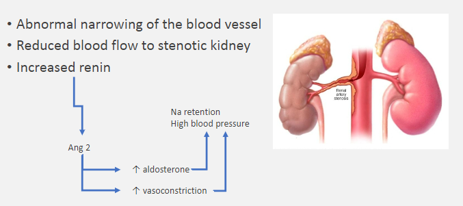 <p><u>Renal artery stenosis leads to:</u></p><p>❀ Reduced blood flow to the stenotic kidney.</p>