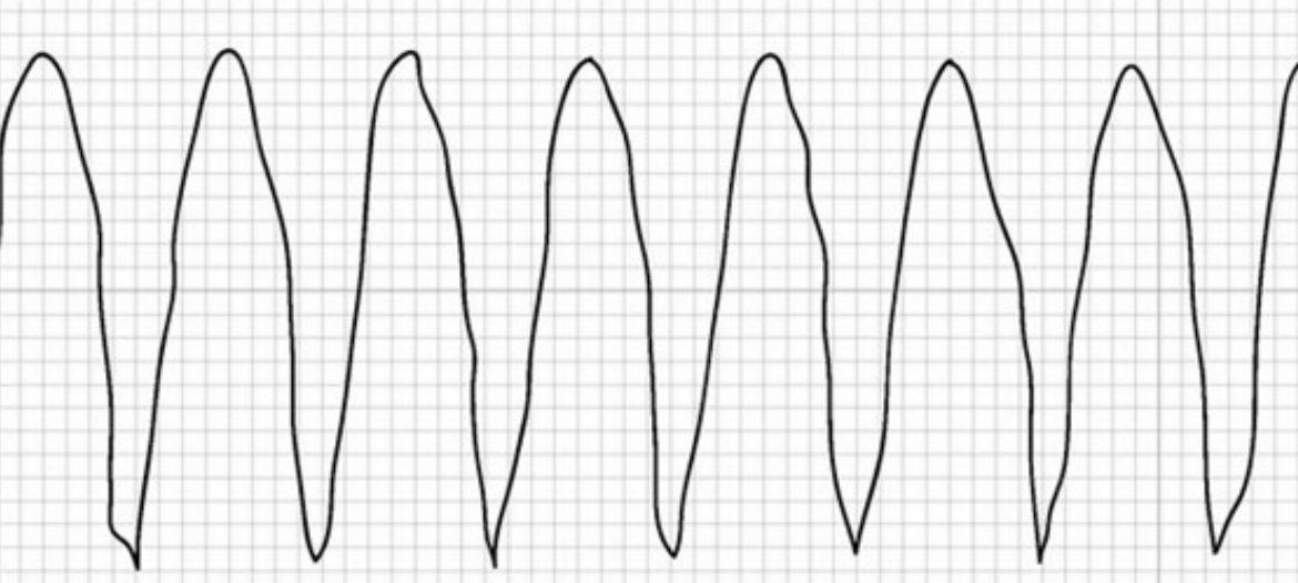 <p>Identify the rhythm pictured</p>