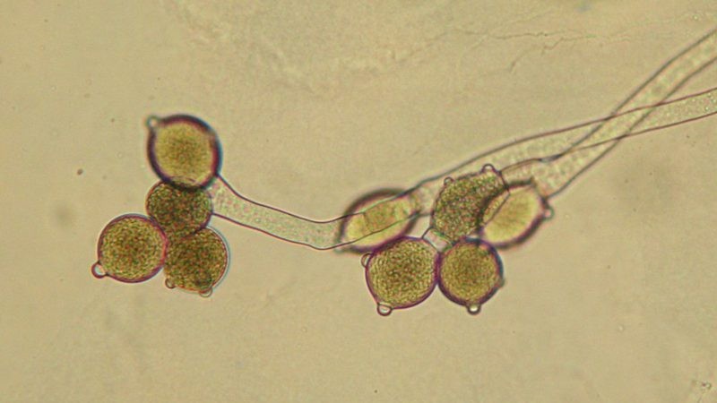 <p><strong>Neocallimastigomycota (Unicellular/Multicellular, Hyphae, Examples, Reproduction)</strong></p>