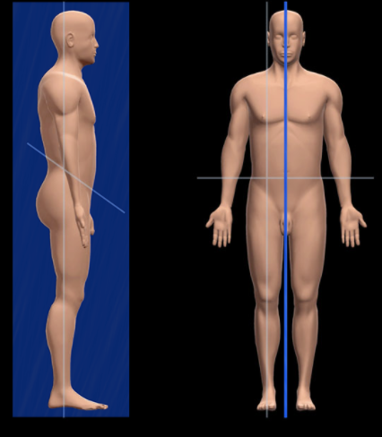 <p>What is the Midsagittal Plane?</p>