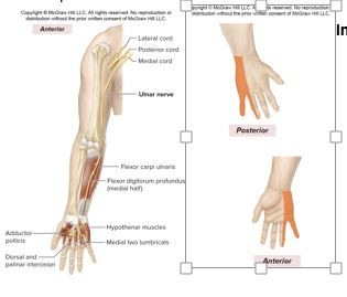 <p>C8-T1</p><p>Formed from the medial cord, anterior division of the brachial plexus</p><p><strong><u>Motor Innervation</u></strong></p><p><strong>Anterior forearm muscles </strong>(<em>flexors of wrist and digits</em>)</p><p>Flexor carpi ulnaris</p><p><strong>Intrinsic hand muscles</strong></p><p>Hypothenar muscles</p><p><u>Cutaneous Innervation</u></p><p>Dorsal and palmar aspects of medial 1-1/2 digits (<em>little finger, medial aspect of ring finger</em>)</p>