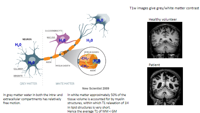 <p>Approximately <strong>50%</strong> of the tissue volume in white matter consists of myelin structures.</p>