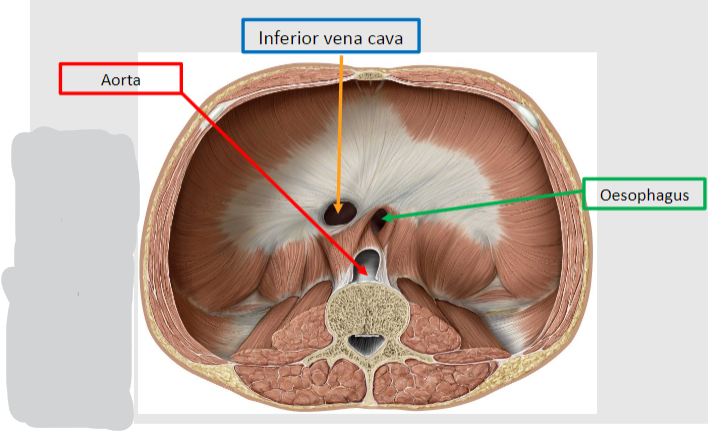 <p><strong>There are three major openings in the diaphragm. </strong></p><p><u>They allow the following structures to pass from the thoracic to the abdominal cavity:</u></p><p>🍮<span class="tt-bg-blue">Inferior vena cava (IVC) </span>passes through at the <span class="tt-bg-blue">T8 </span>level.</p><p>🍮<span class="tt-bg-yellow">Esophagus</span> passes through at the <span class="tt-bg-yellow">T10</span> level.</p><p>🍮<span class="tt-bg-red">Aorta</span> passes through at the <span class="tt-bg-red">T12</span> level.</p>
