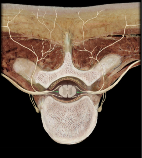 <p>Where is the the Denticulate Ligament located? </p>